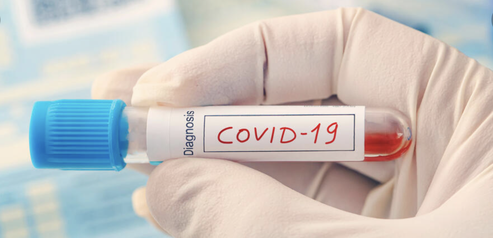 Test Sierologico COVID-19